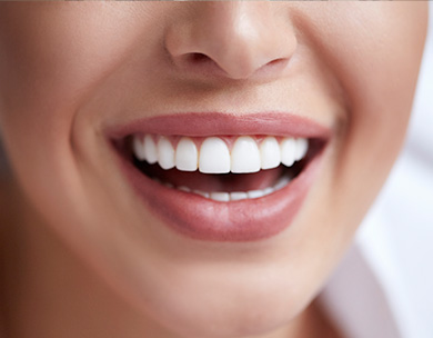 orlando cosmetic dentistry