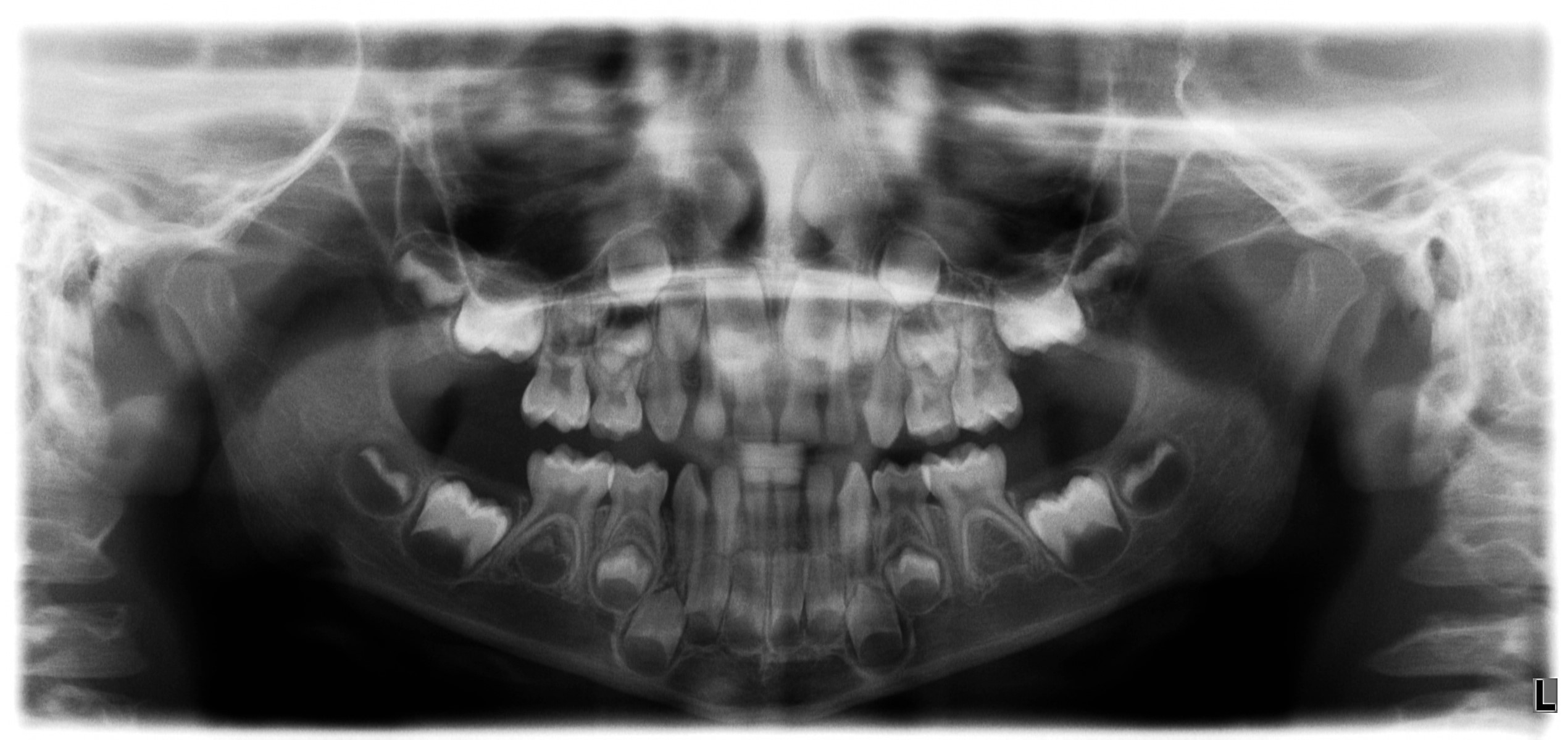 panoramic x-ray