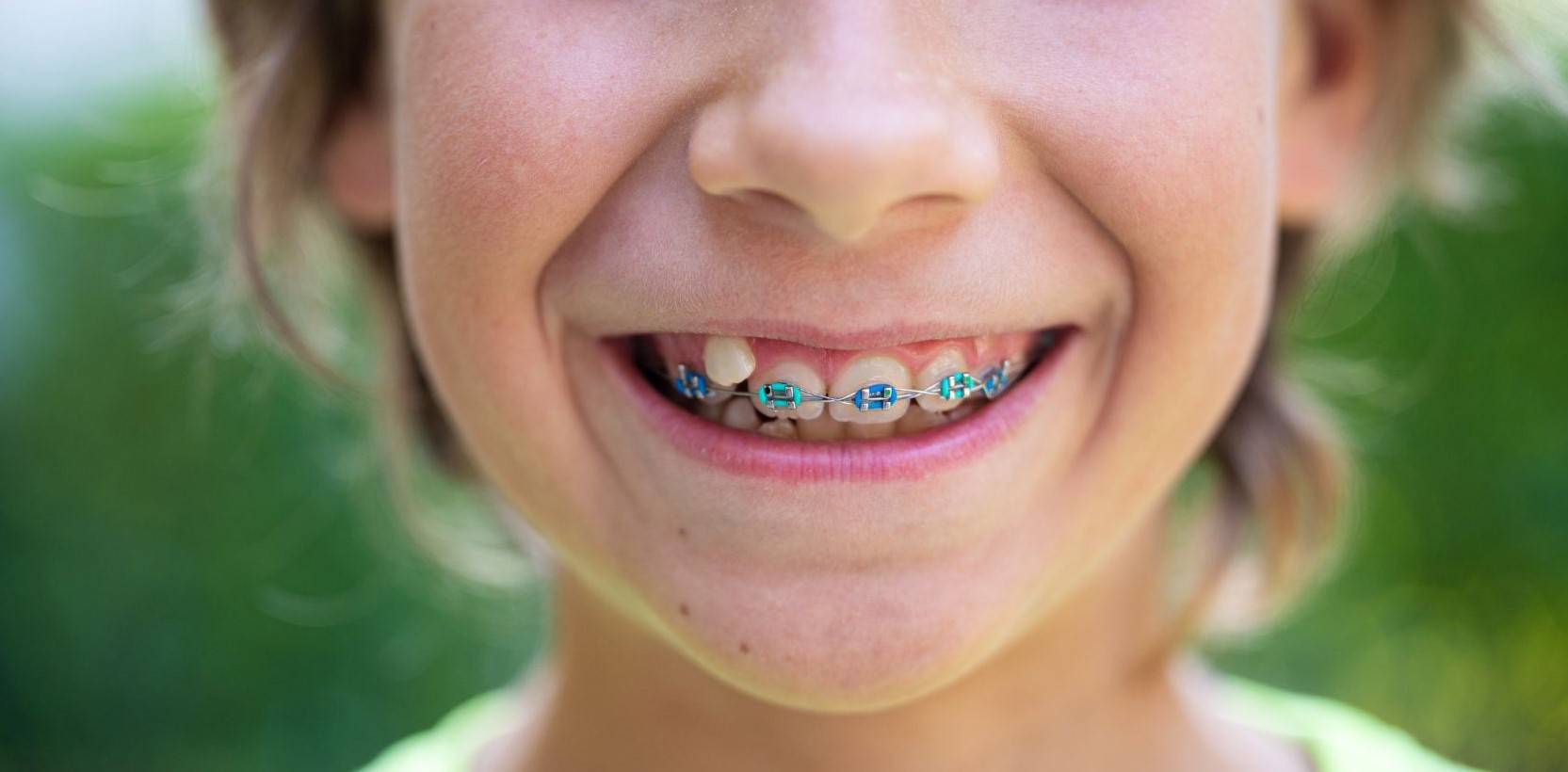 orthodontist child with braces