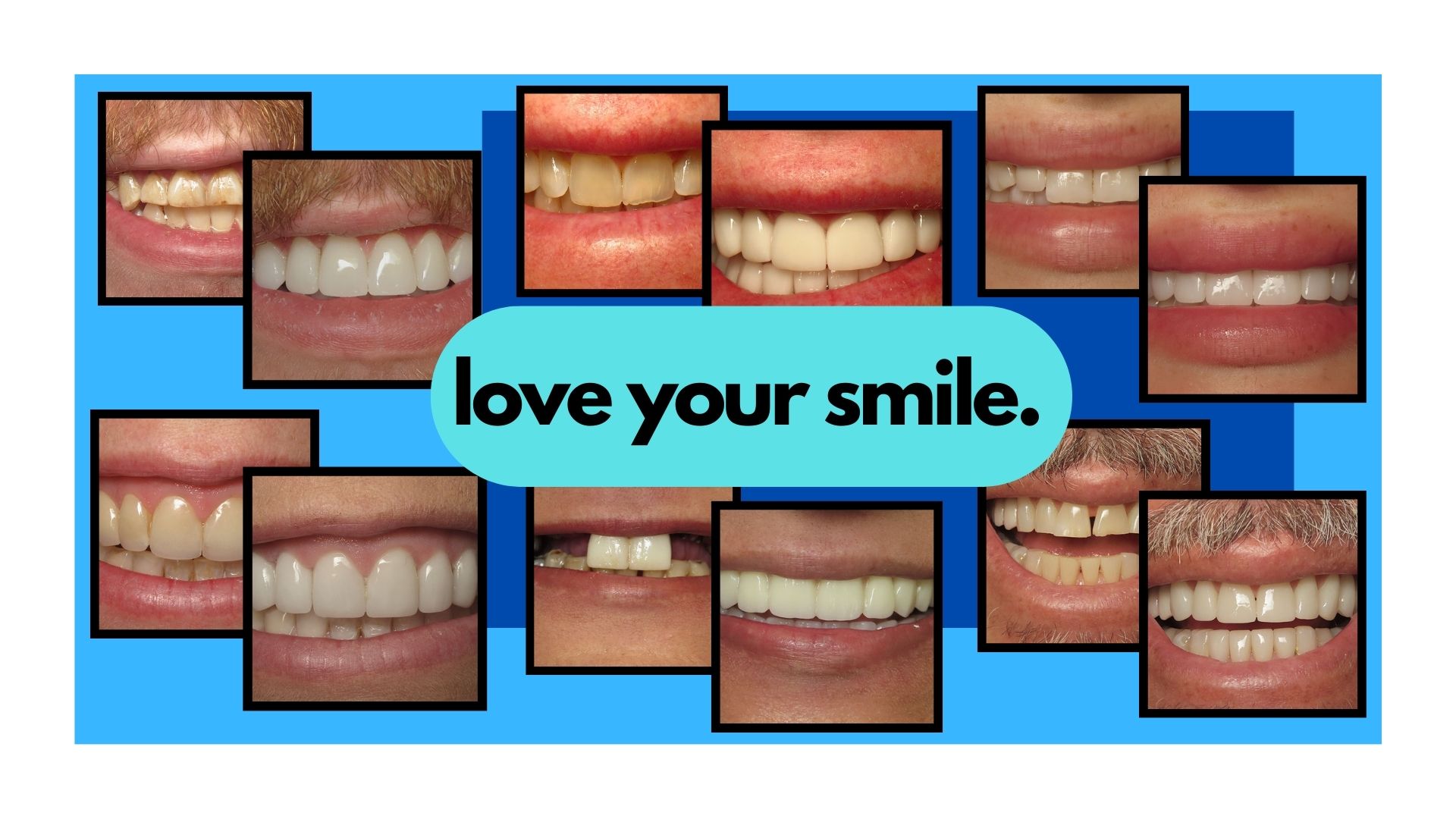 smile makeovers can help you love your smile
