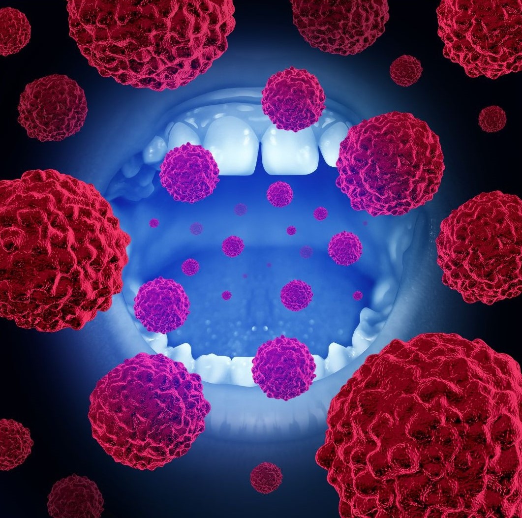 HPV oral cancer