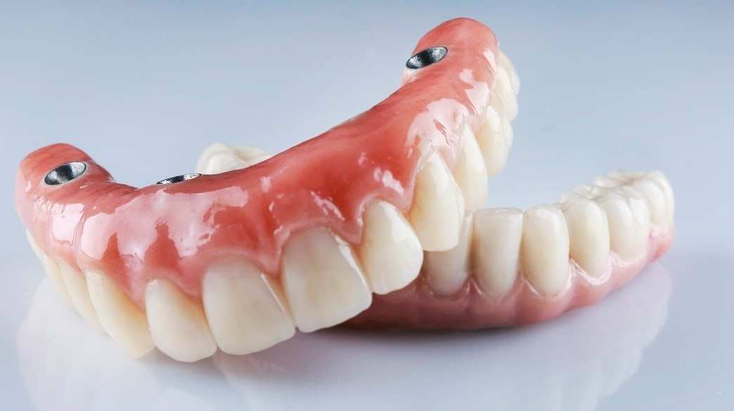 snap-on dentures