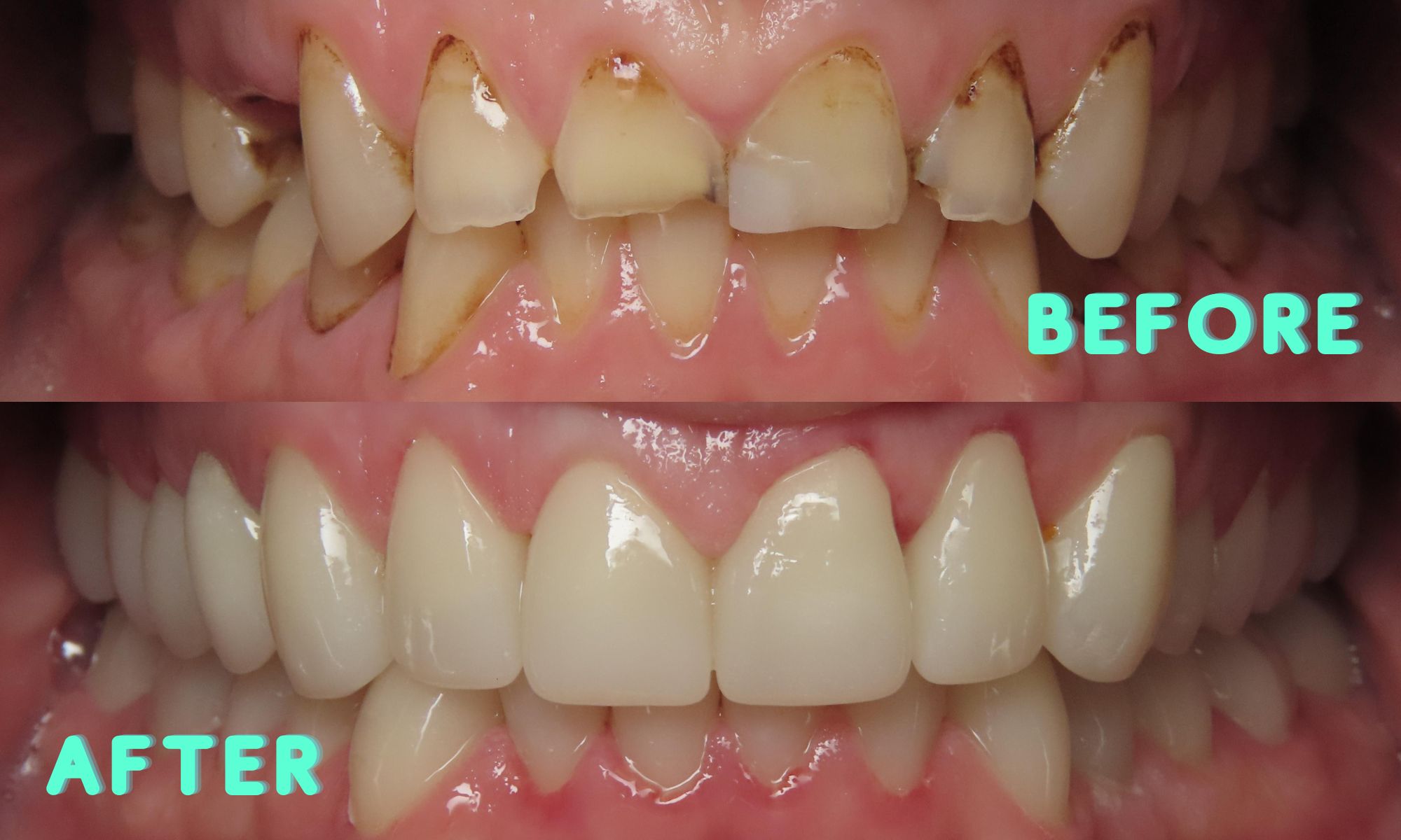 Dental phobia dental anxiety cosmetic dentistry smile makeover